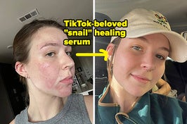 before and after face serum 