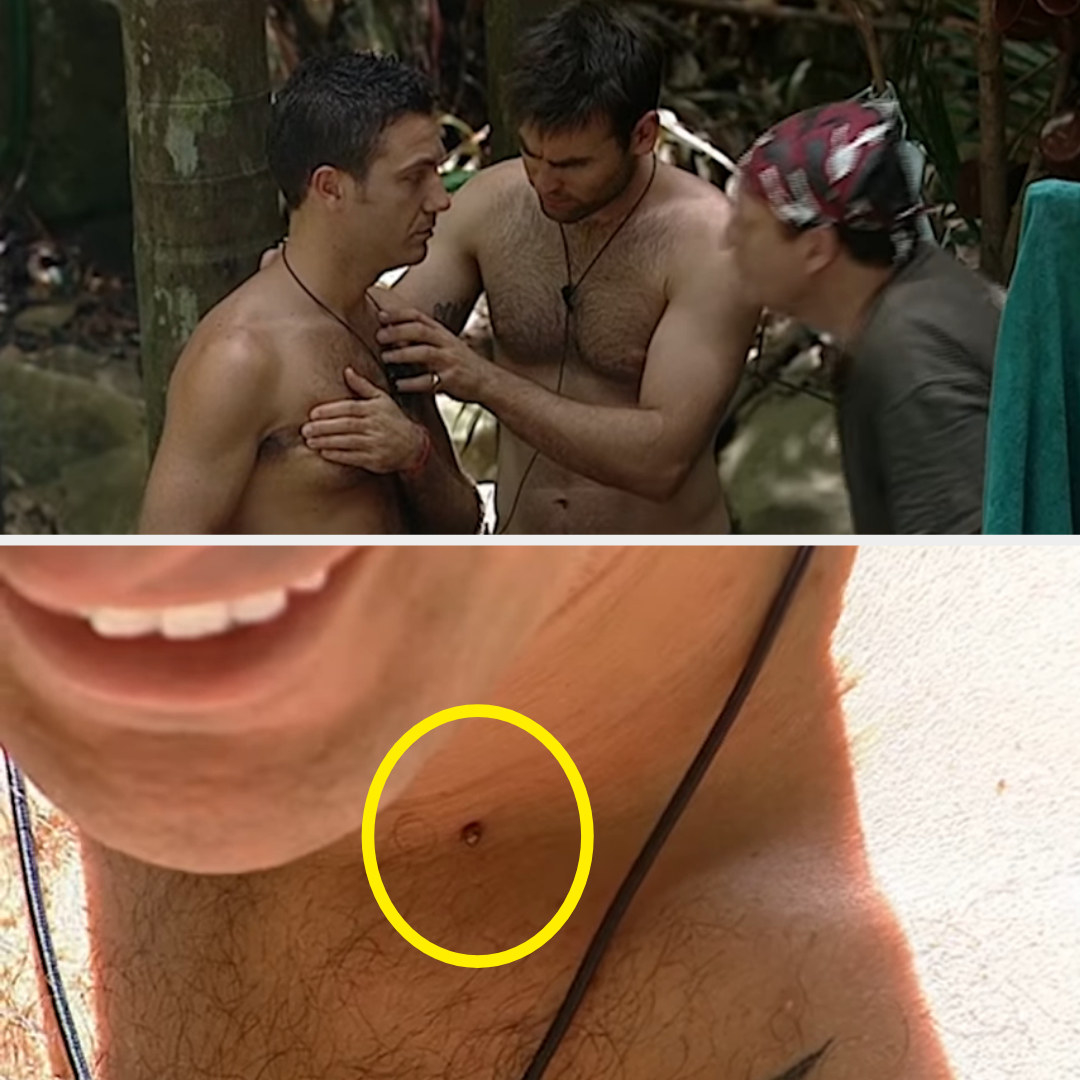 contestant with a tick in his neck