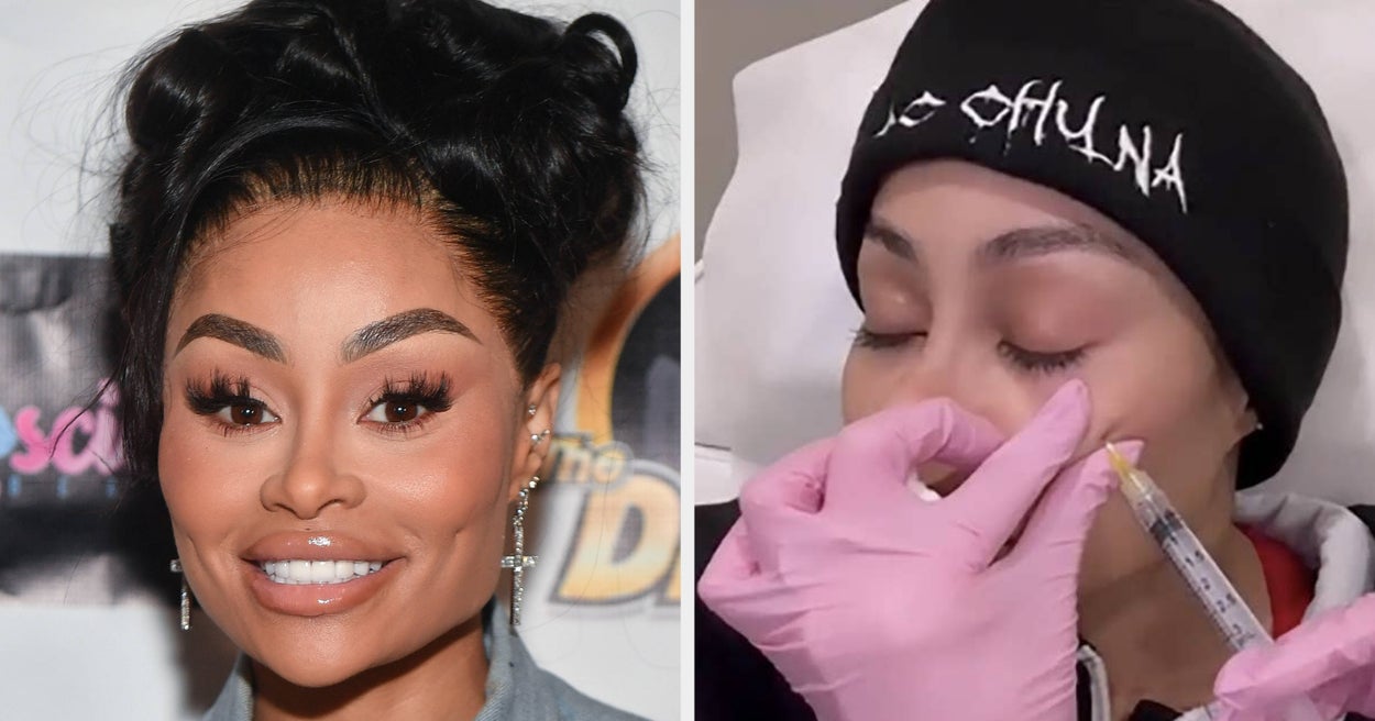 Blac Chyna Said She’s Happy That Her Face No Longer Looks “Super Boxy” As She Addressed The Public Reaction To Her Getting Her Fillers Dissolved