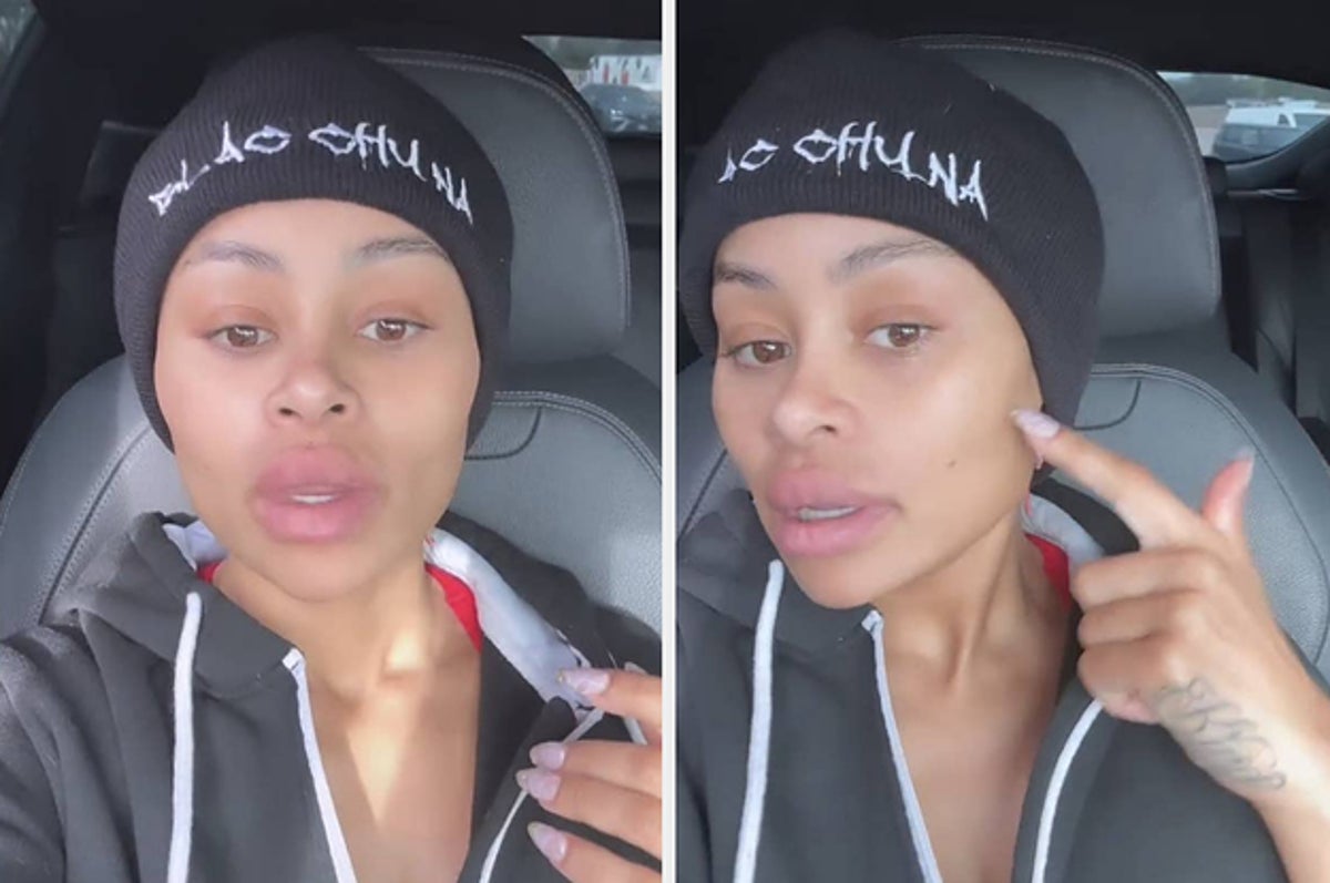 Blac Chyna Warns Fans Not To Get Facial Fillers Too Young