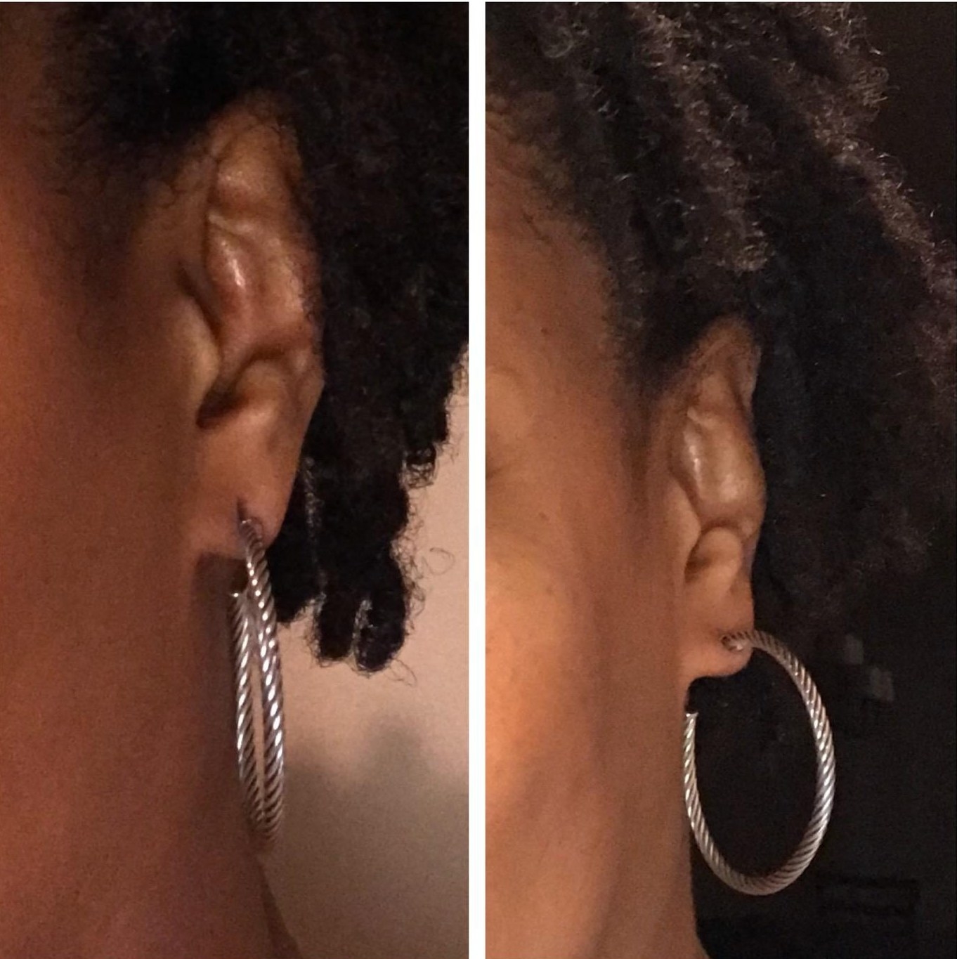 reviewer wearing hoops with droopy stretched piercing hole before then earring perky without visible stretching after