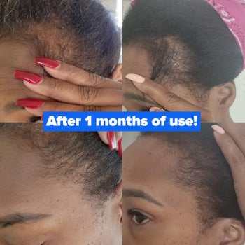 a reviewer showing off new hair growth after using the oil and text reading 
