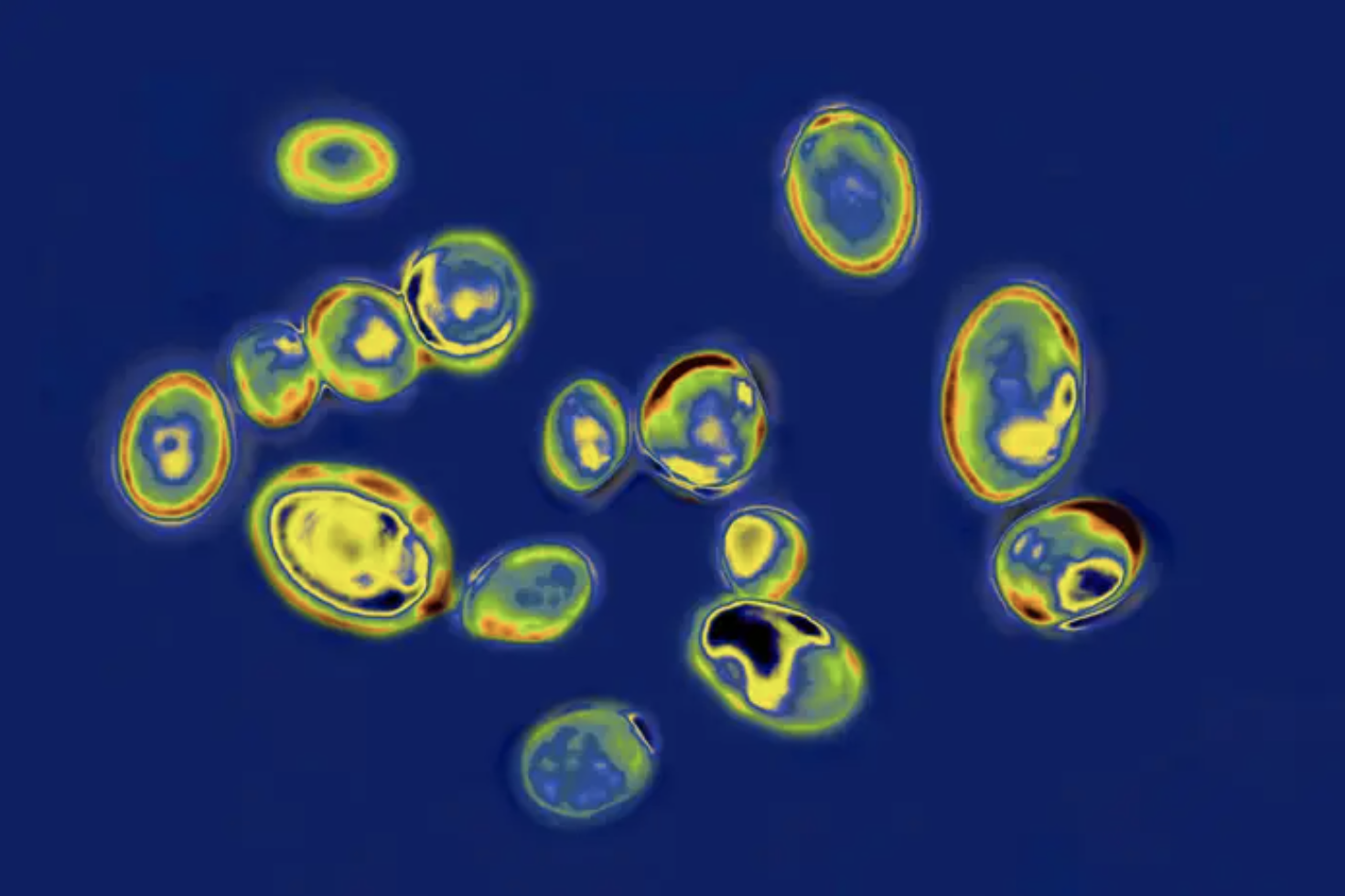 a microscopic view of greenish blue pathogen particles