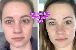 reviewer before and after using eye cream