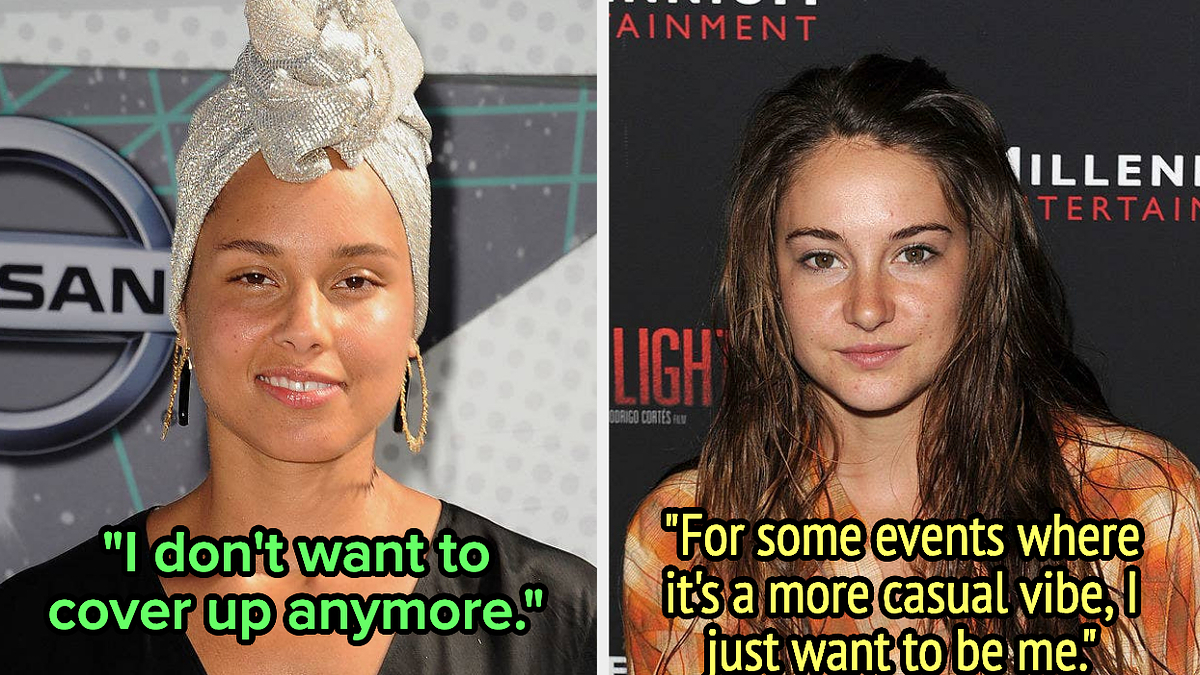 17 Time Celebs Ditched Makeup Onstage