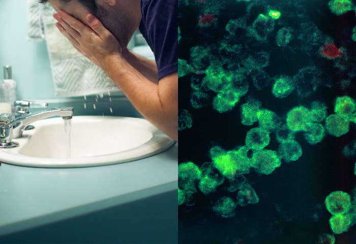 A split image shows a man washing his face over a sink on the left, on the right we see flourescent amoeba under 630 times magnification