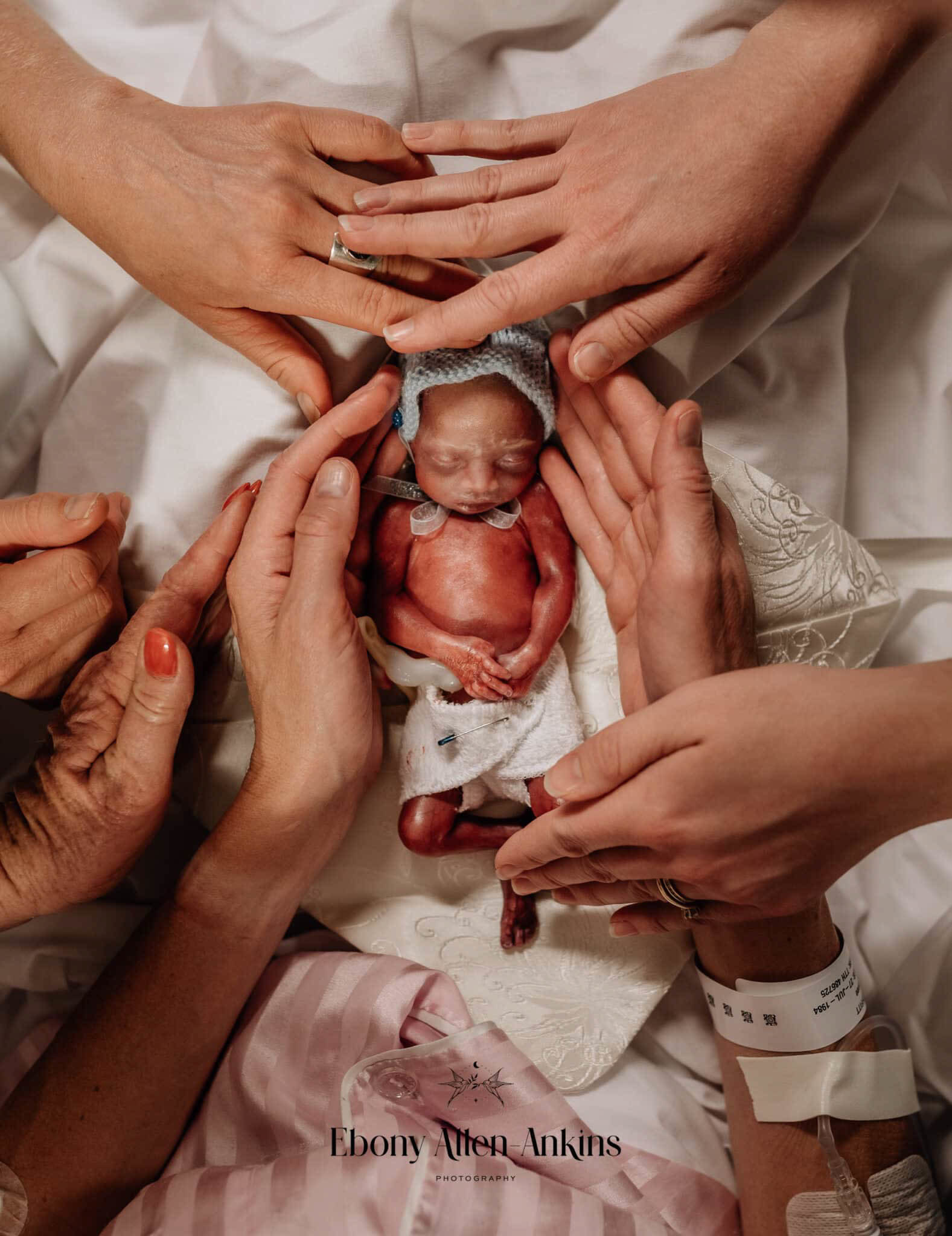 Dutch photographer Mary Fermont takes stunning photos moments after babies  are born