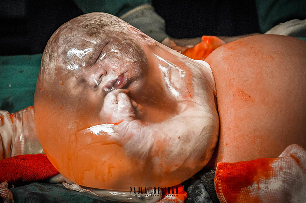 23 Award-Winning Birth Photos From 2022 That Put You Right In The Room Where It Happens