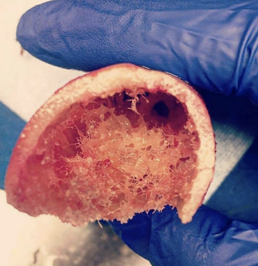 Fibrousy-looking inside of a human bone