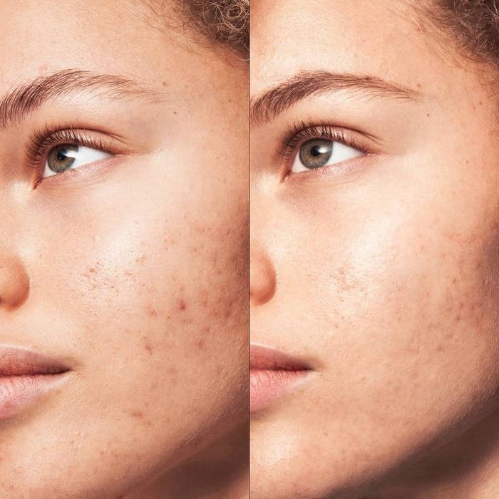 A models before and after photo of using the product