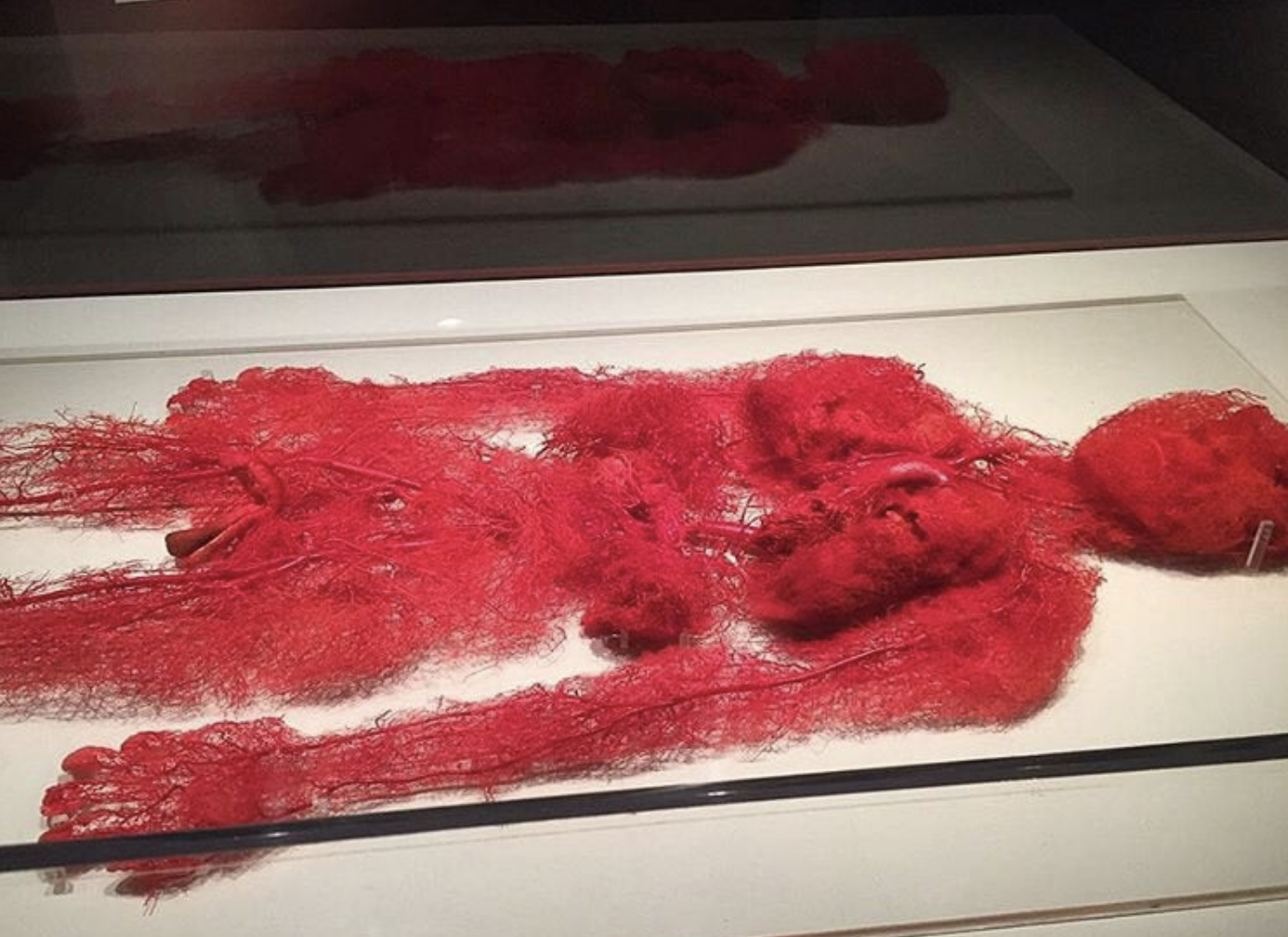 Red blood vessels in the shape of a human body, without skeleton, skin, or other organs, on a mattress