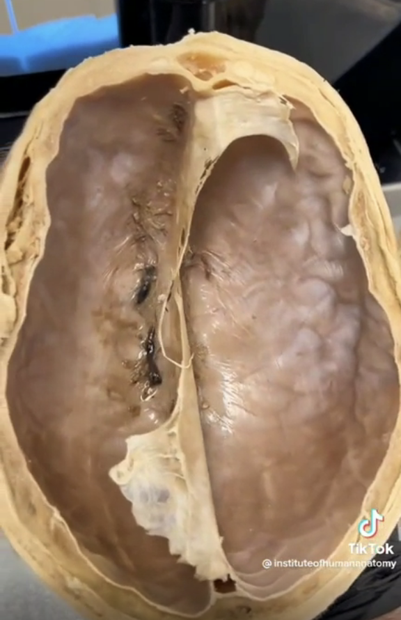 Closeup of inside the human skull
