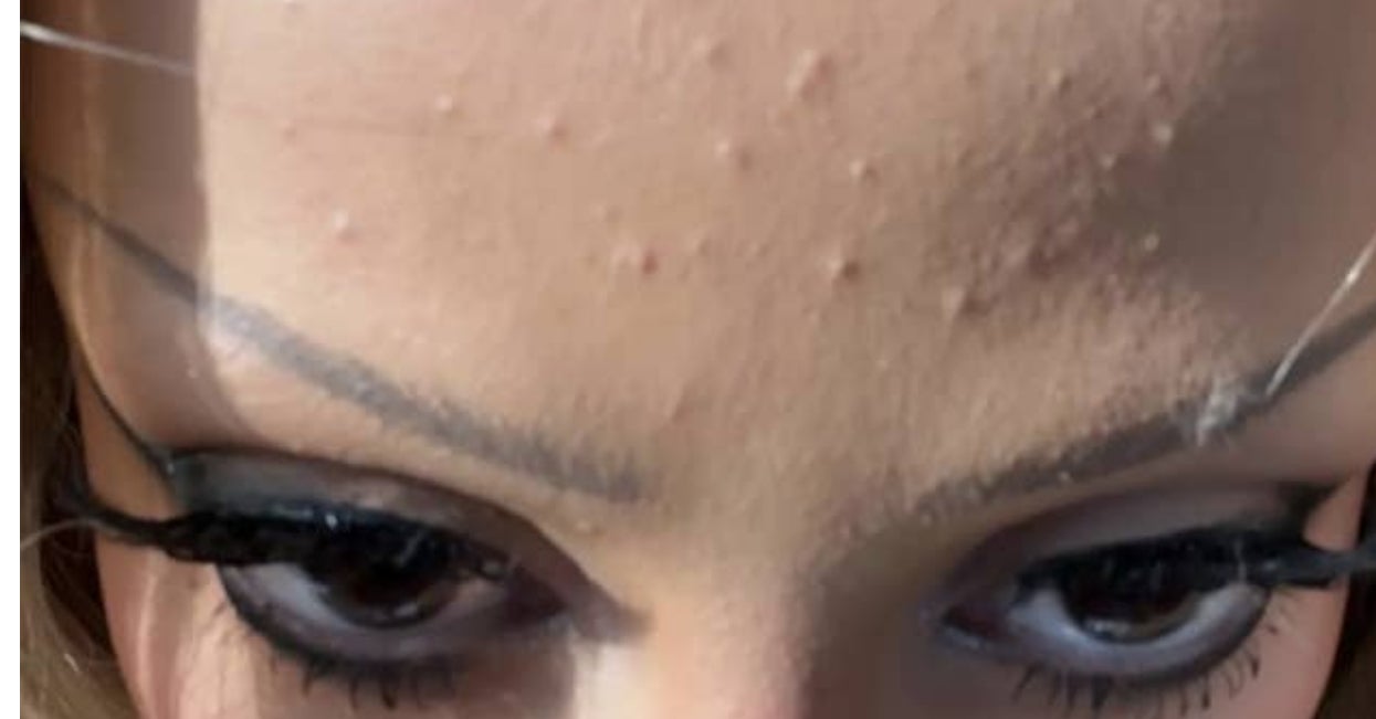 Doja Cat Posted The Reality Of Her Red Carpet Skin And It’s Refreshing AF