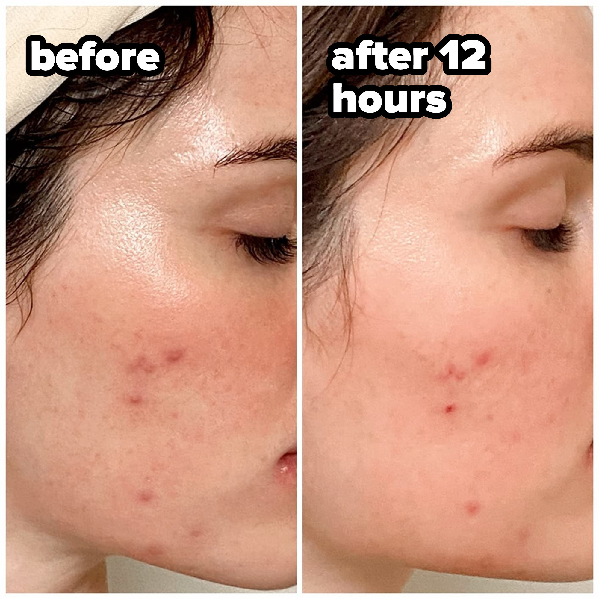 a reviewer&#x27;s before and after shots with 12 hours in between