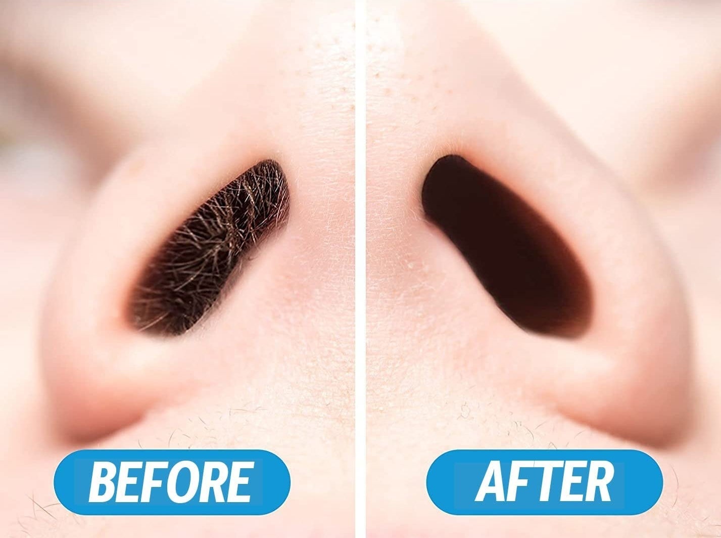 a before and after of the inside of someone&#x27;s nose
