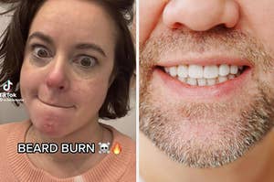 side by side of Tiktok screencap of woman's chin, and a man's beard