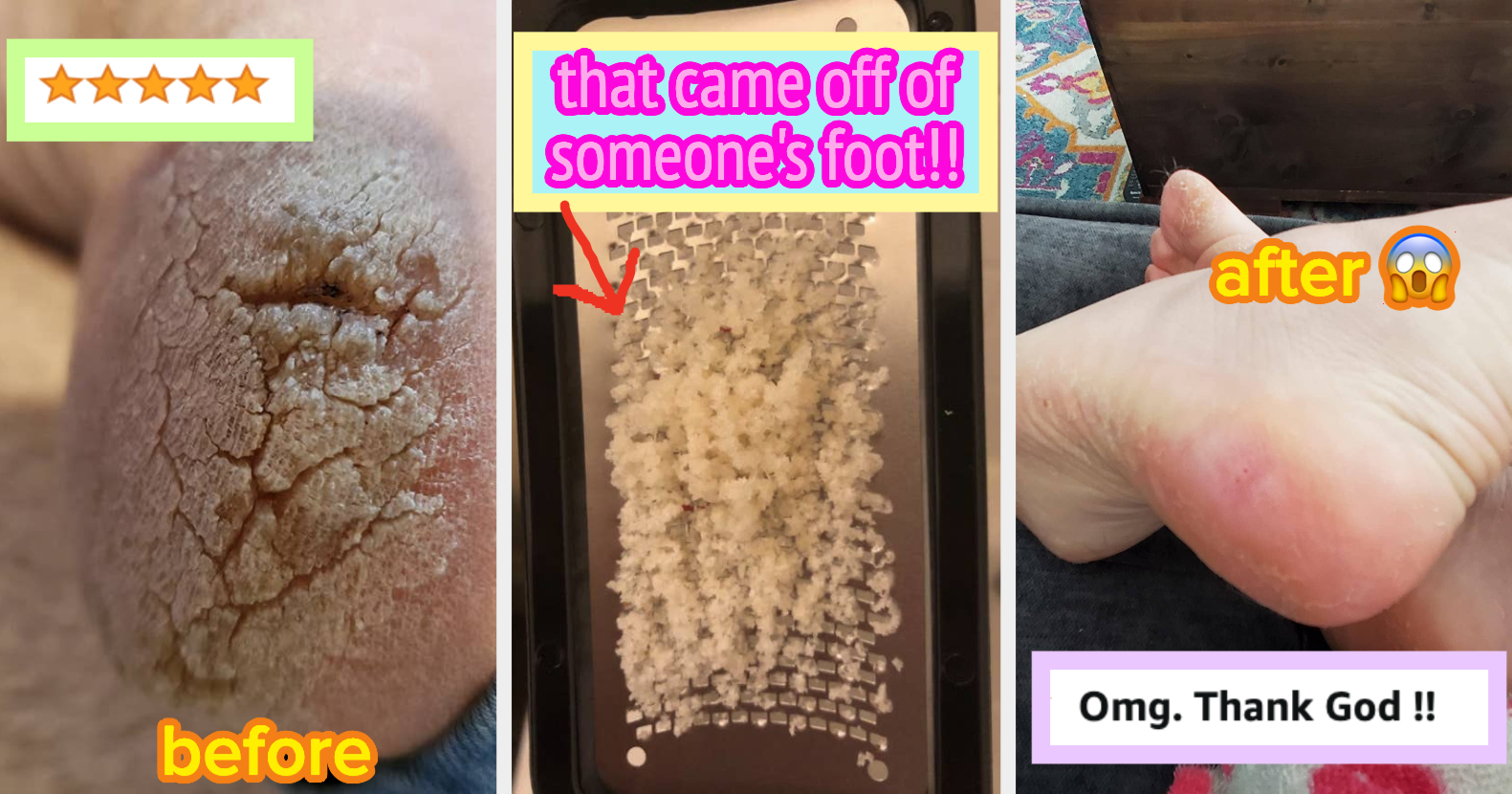 How to remove dead skin from your feet – Next Gay Thing