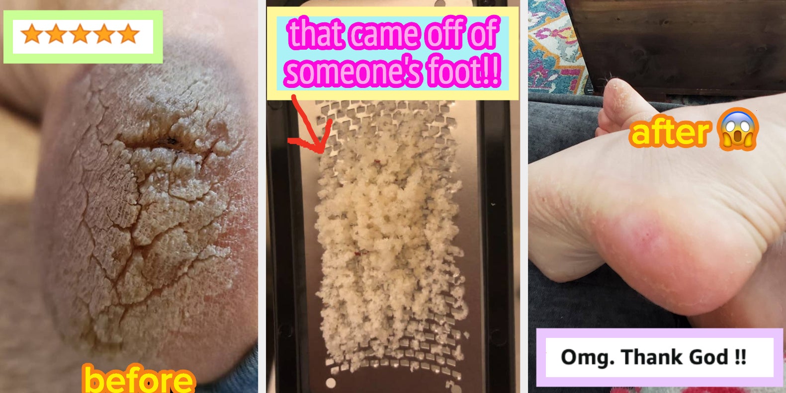 This $14 Lee Beauty Callus-Removing Gel Is Magical - Vimarsana News