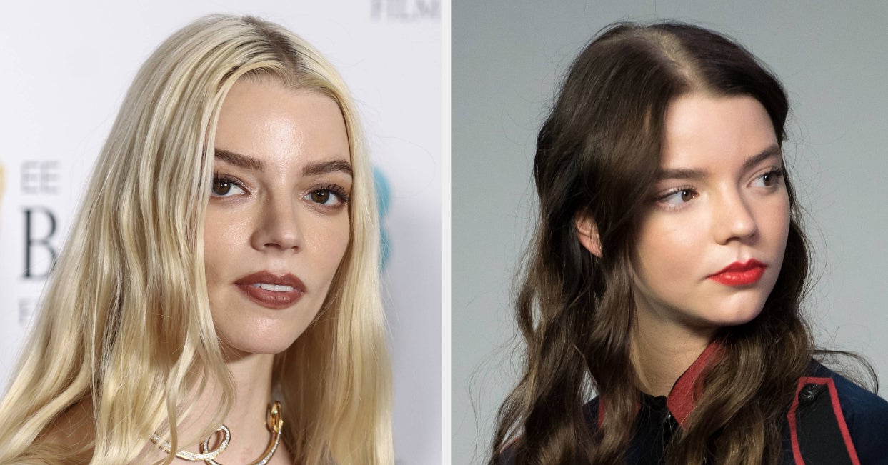 Anya Taylor-Joy Was Once Asked If She’s “Self-Conscious” Because Her Eyes Are “So Far Apart” During An Interview, And It’s Truly Heartbreaking