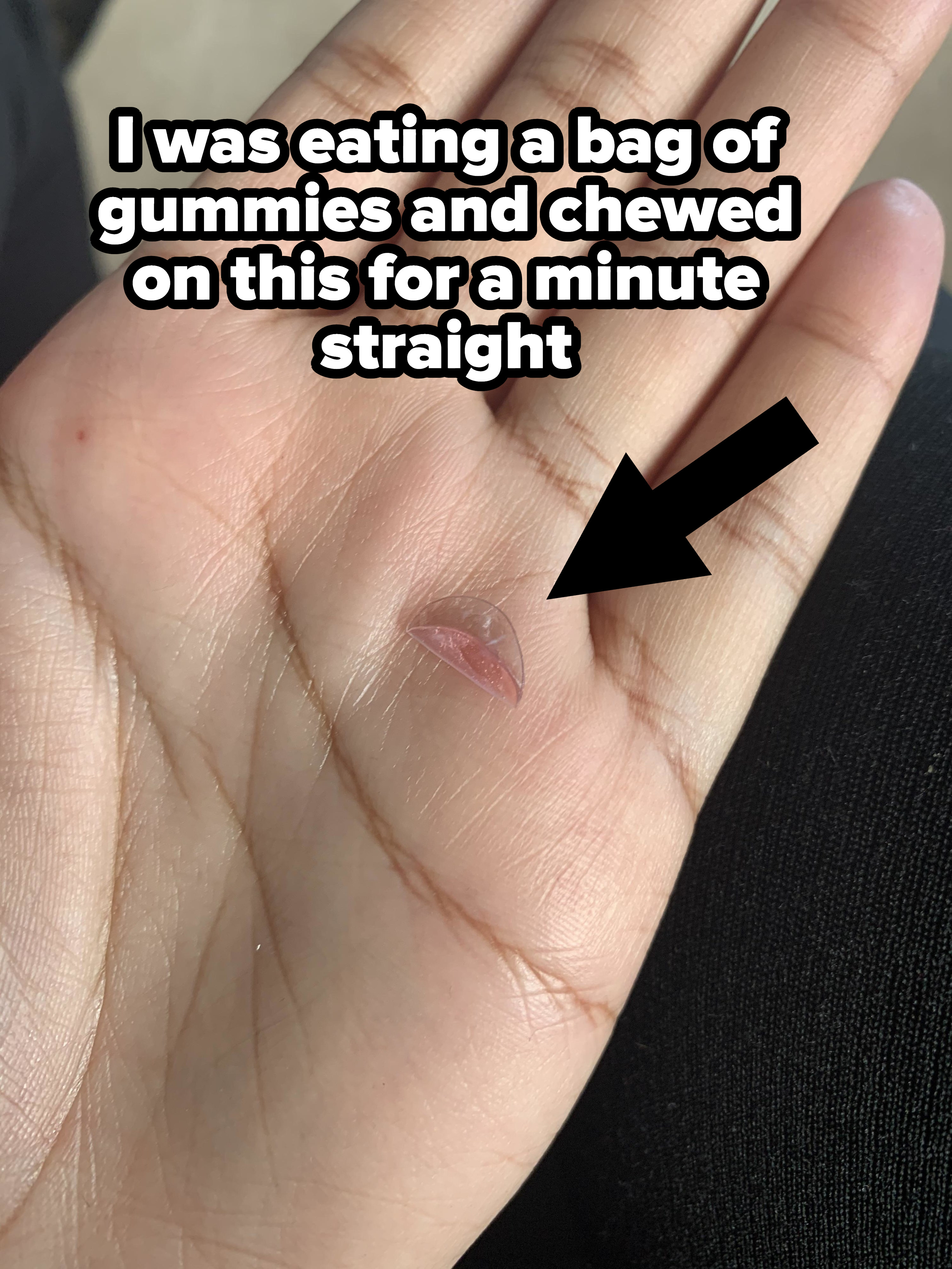 A person holding a squashed contact lens they were chewing on that they found in a bag of gummies
