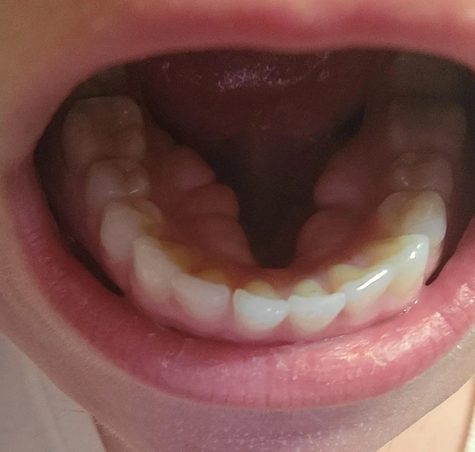 closeup of the person&#x27;s mouth