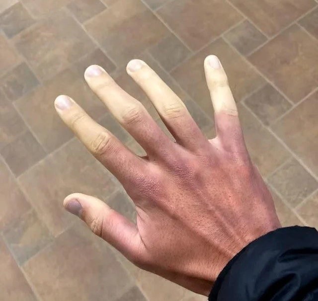 pale fingers