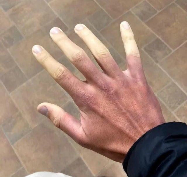 pale fingers