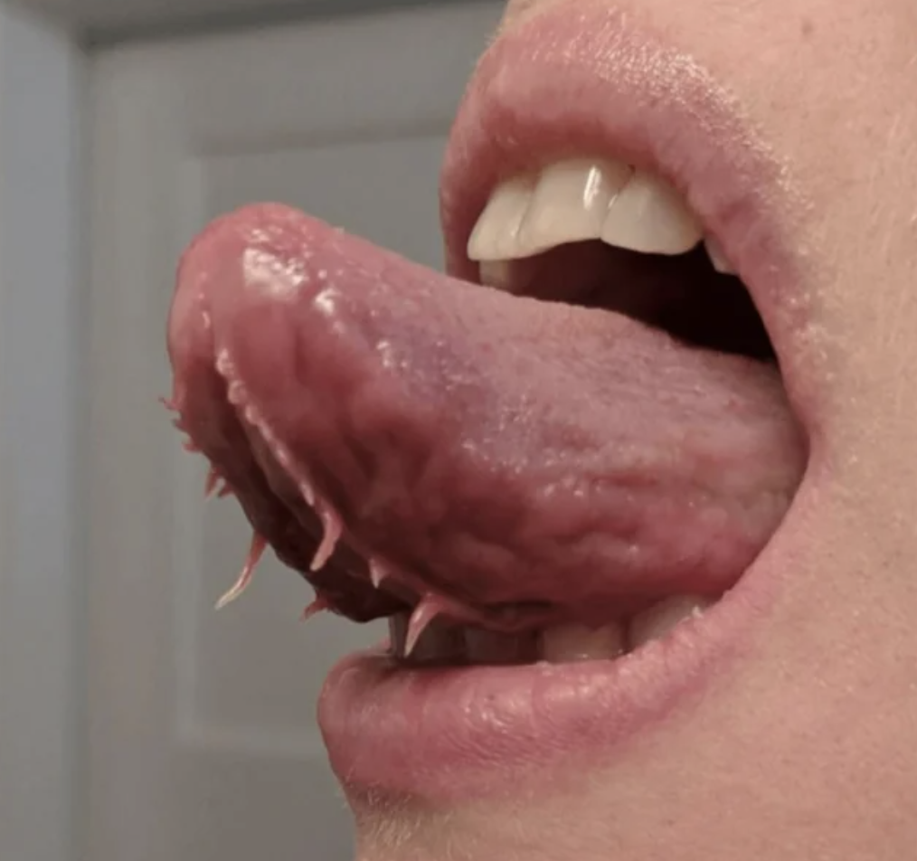 A tongue extending from a mouth with what look like tiny, sharp teeth underneath it