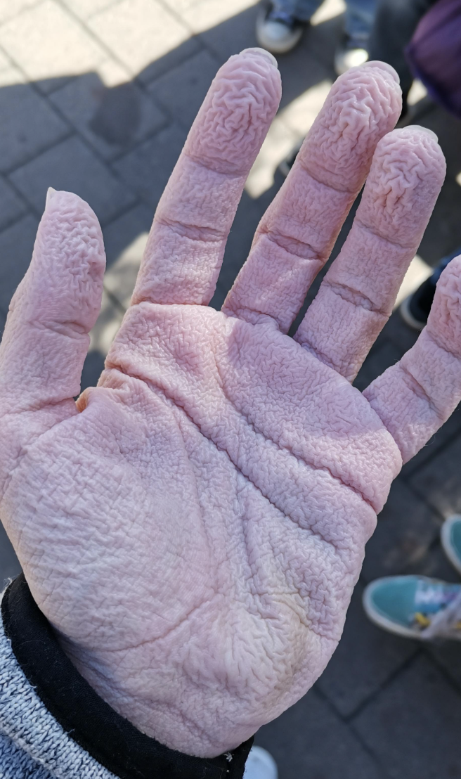 Close-up of waterlogged, wrinkled hand