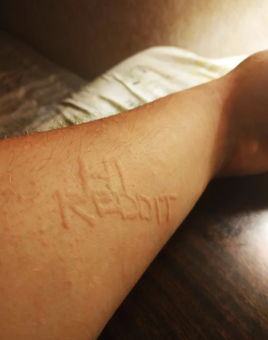 &quot;Hi Reddit&quot; written on someone&#x27;s arm
