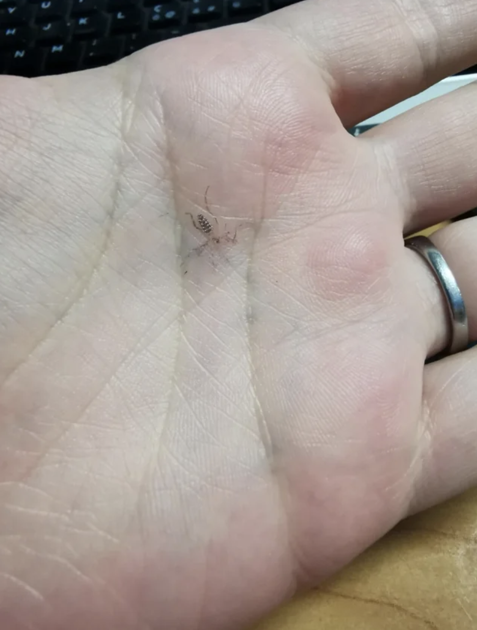 A mosquito imprint on someone&#x27;s palm