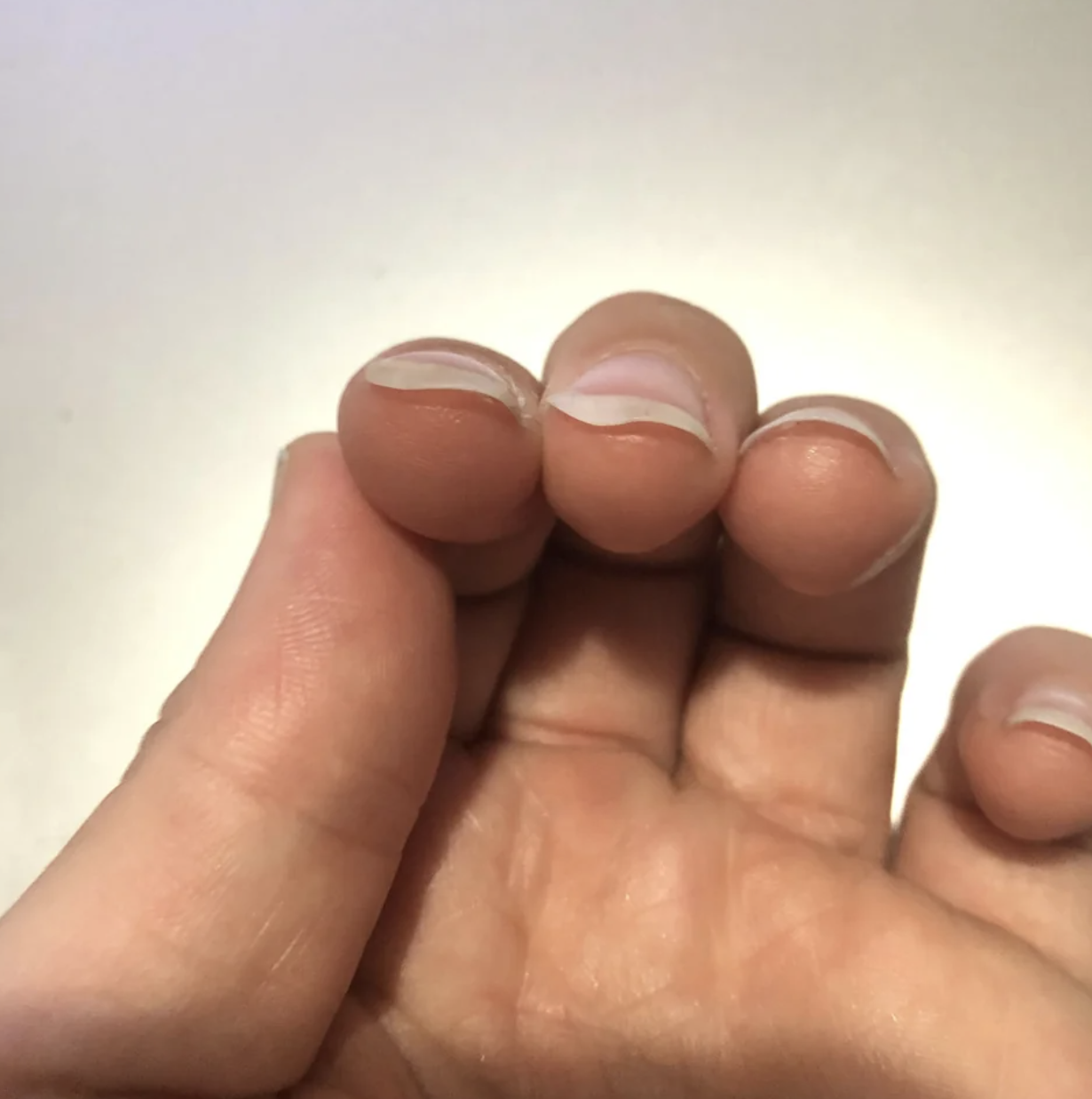 Closeup of someone&#x27;s fingernails