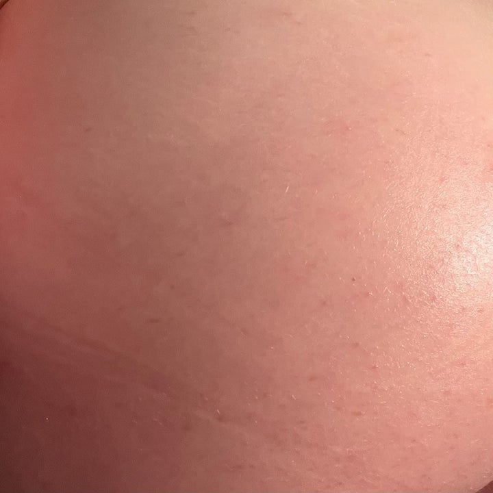 a photo of the same reviewer with their skin now clean