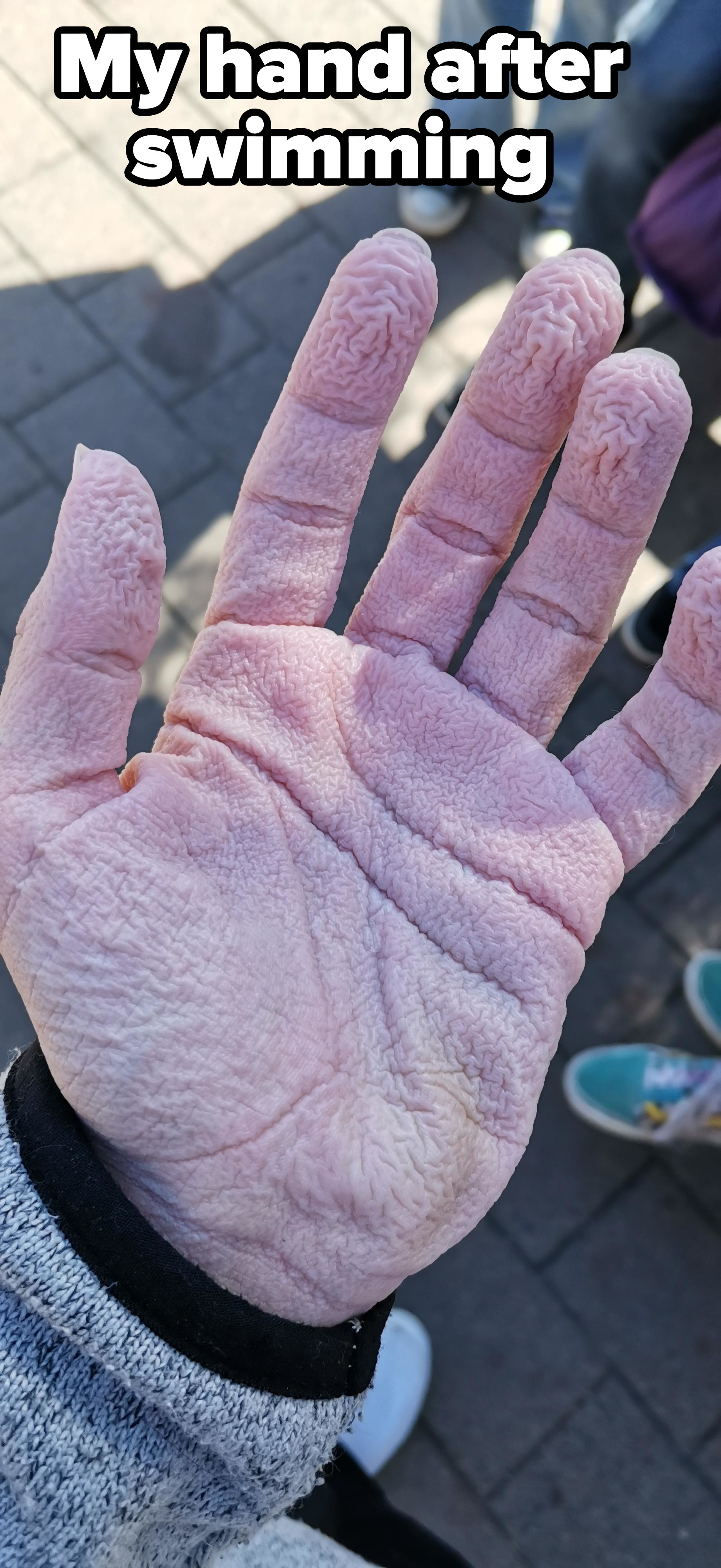 Very wrinkly hands after swimming