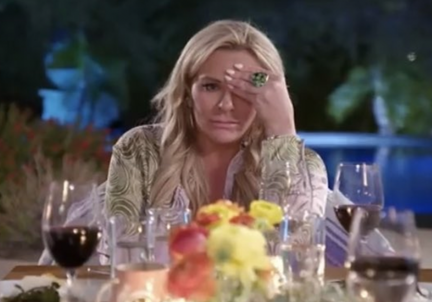 woman with hand to forehead speechless