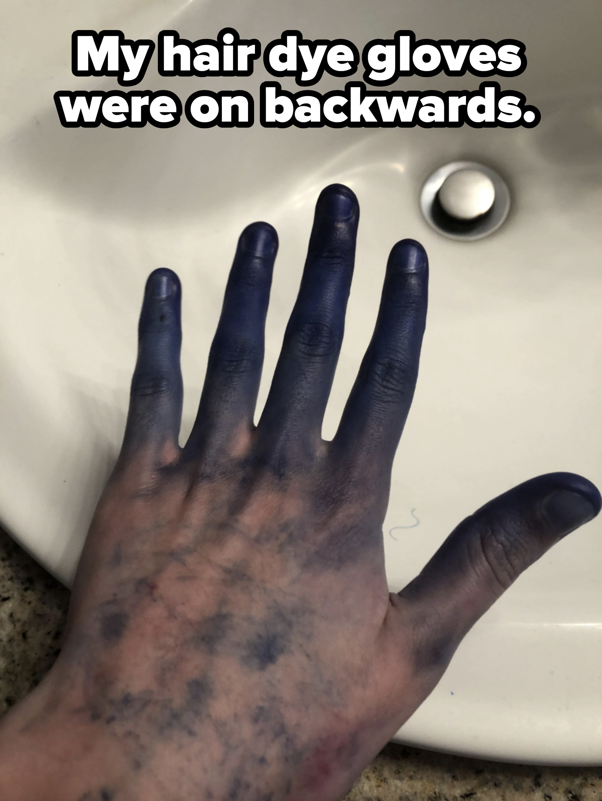 A hand covered in blue dye