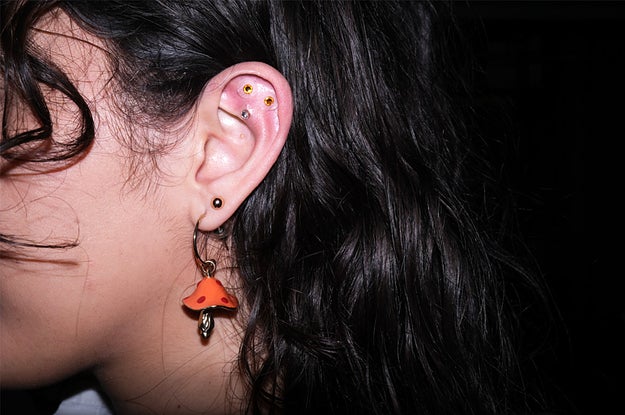 I Tried Ear Seed Acupressure For Lower Back Pain - Vimarsana News