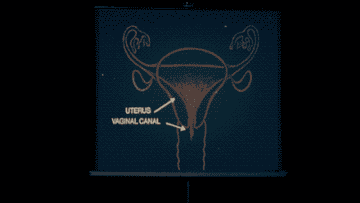 A girl grimaces in disgust at a diagram of a uterus and birth canal