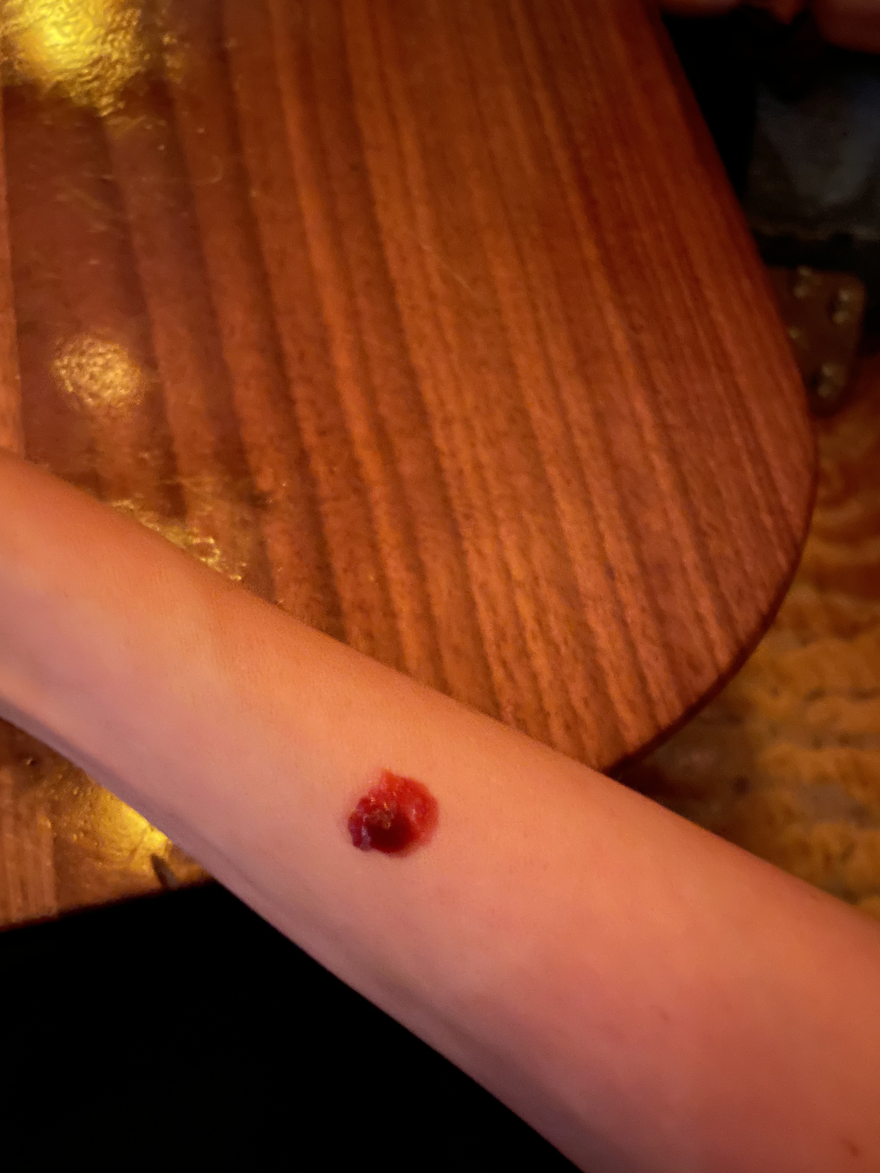 Lara&#x27;s arm with ketchup