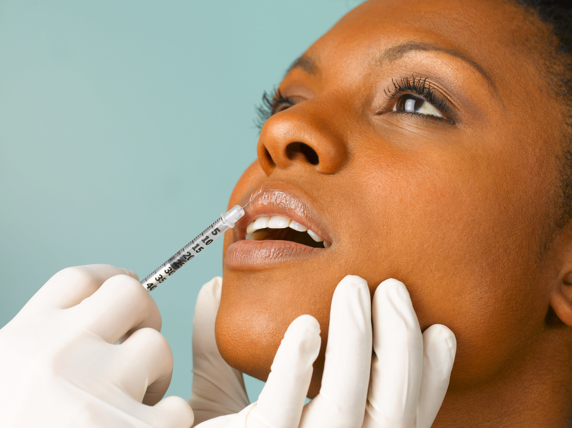 Someone getting an injectable into their top lip