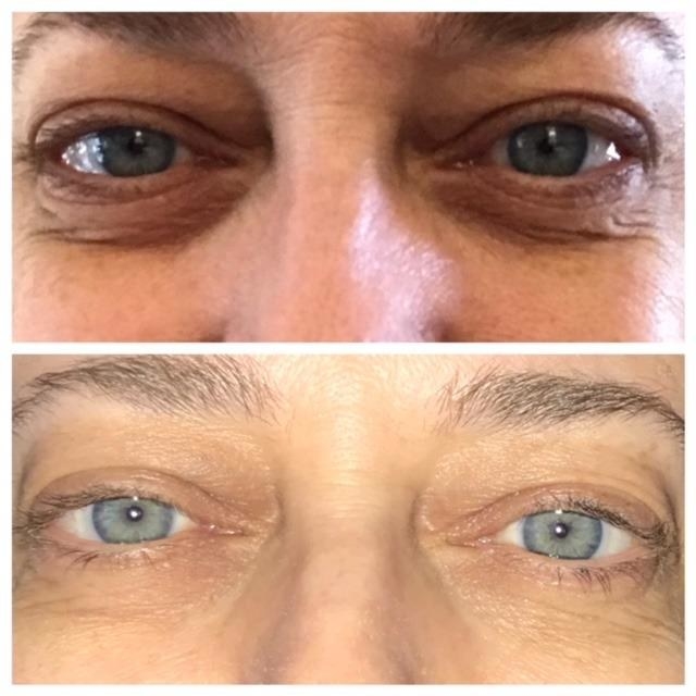 A reviewer's before and after photo of using this product