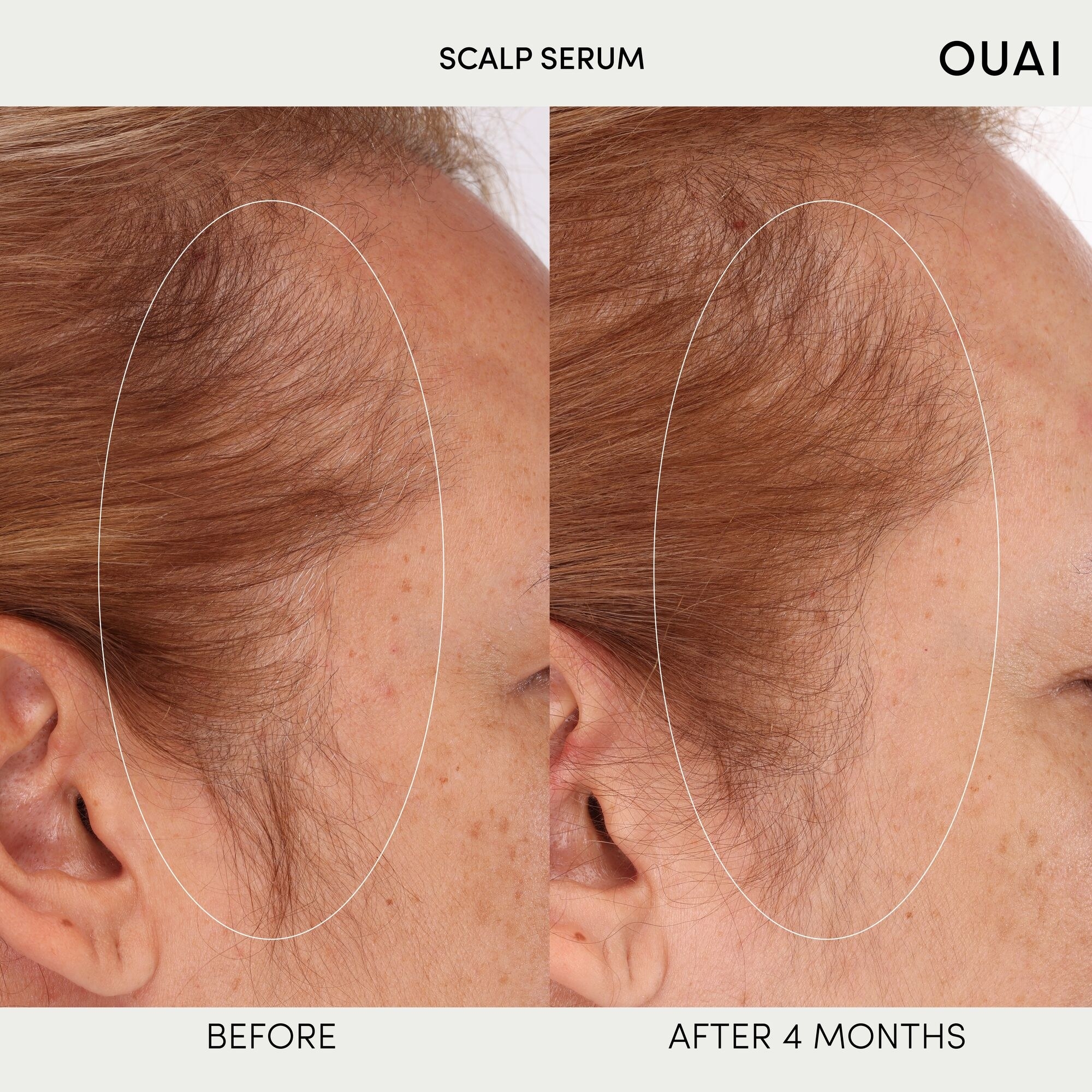 a before and after photo using the Ouai Hydrating Scalp Serum