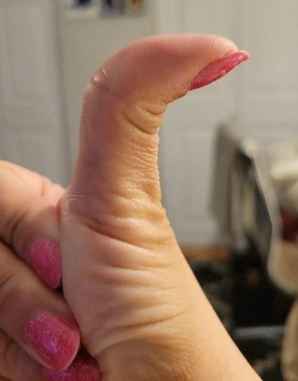 Thumb bent at an unusual angle due to flexibility, with matching pink nail polish on fingernails