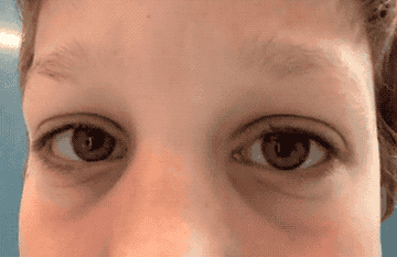 Close-up of a person&#x27;s eyes looking directly at the camera, eyebrows slightly raised