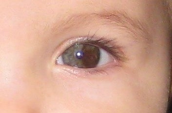 closeup of the eye
