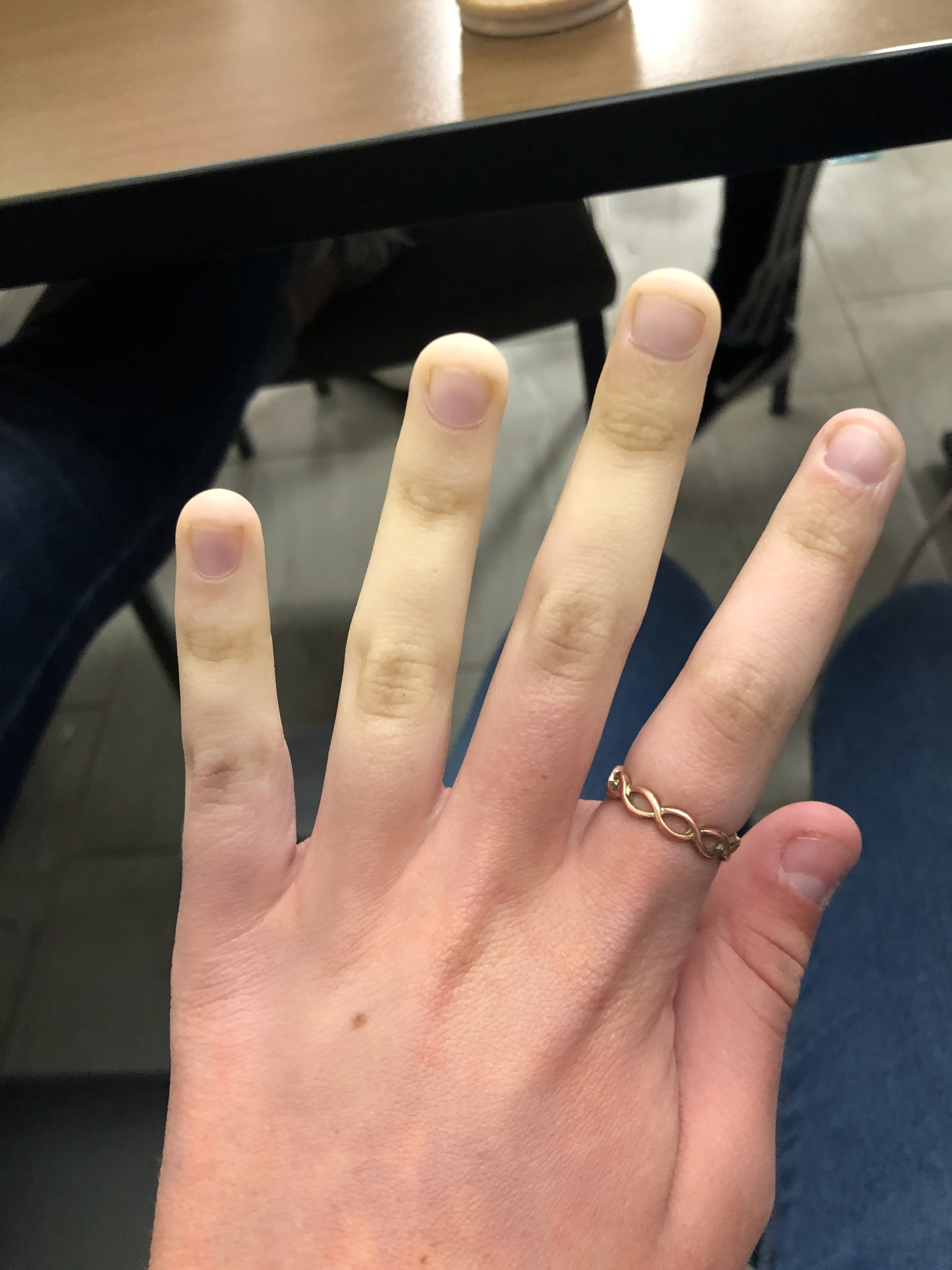 half of the hand is pale