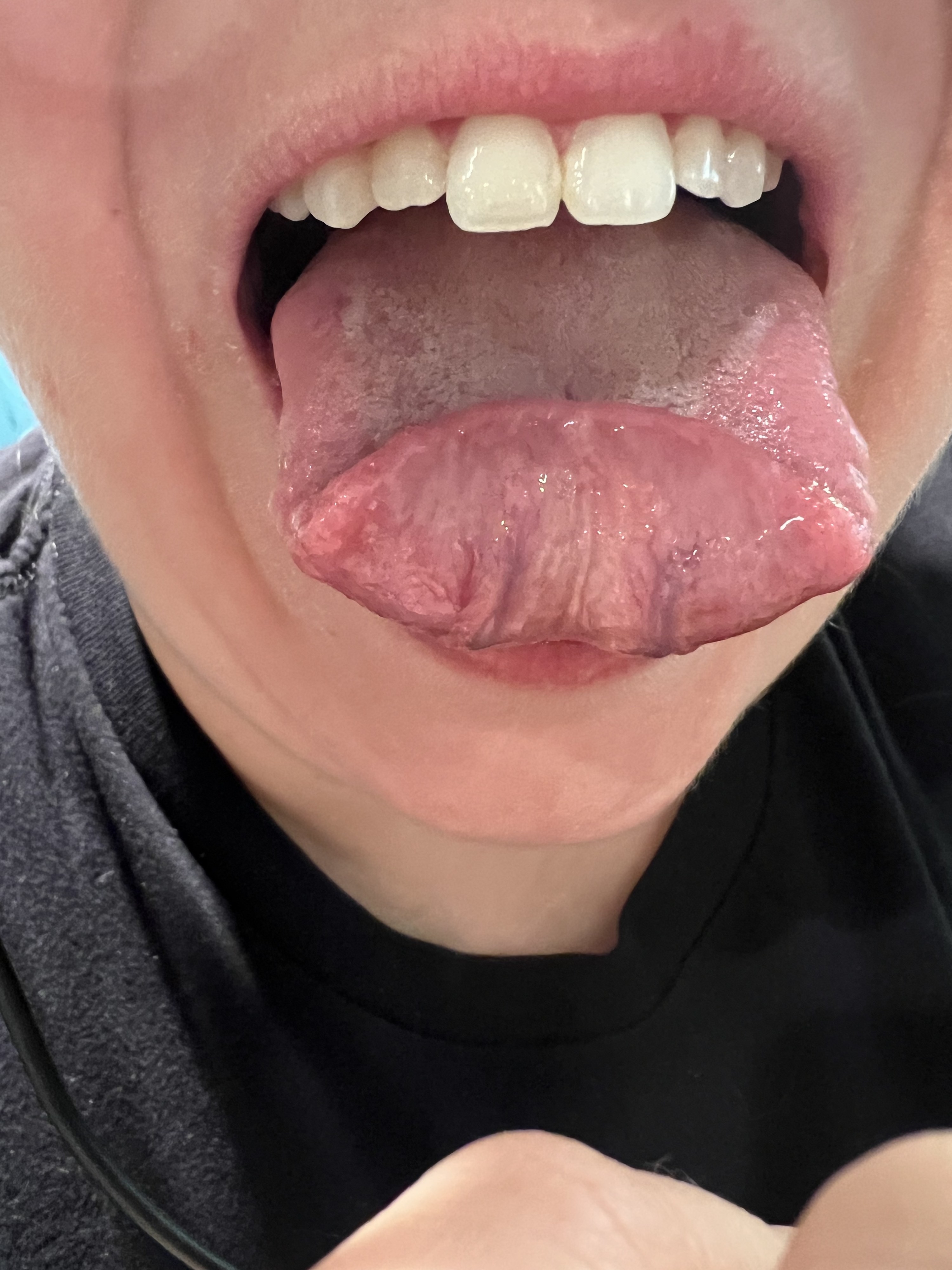 Close-up of a person sticking out their tongue folded in half upwards