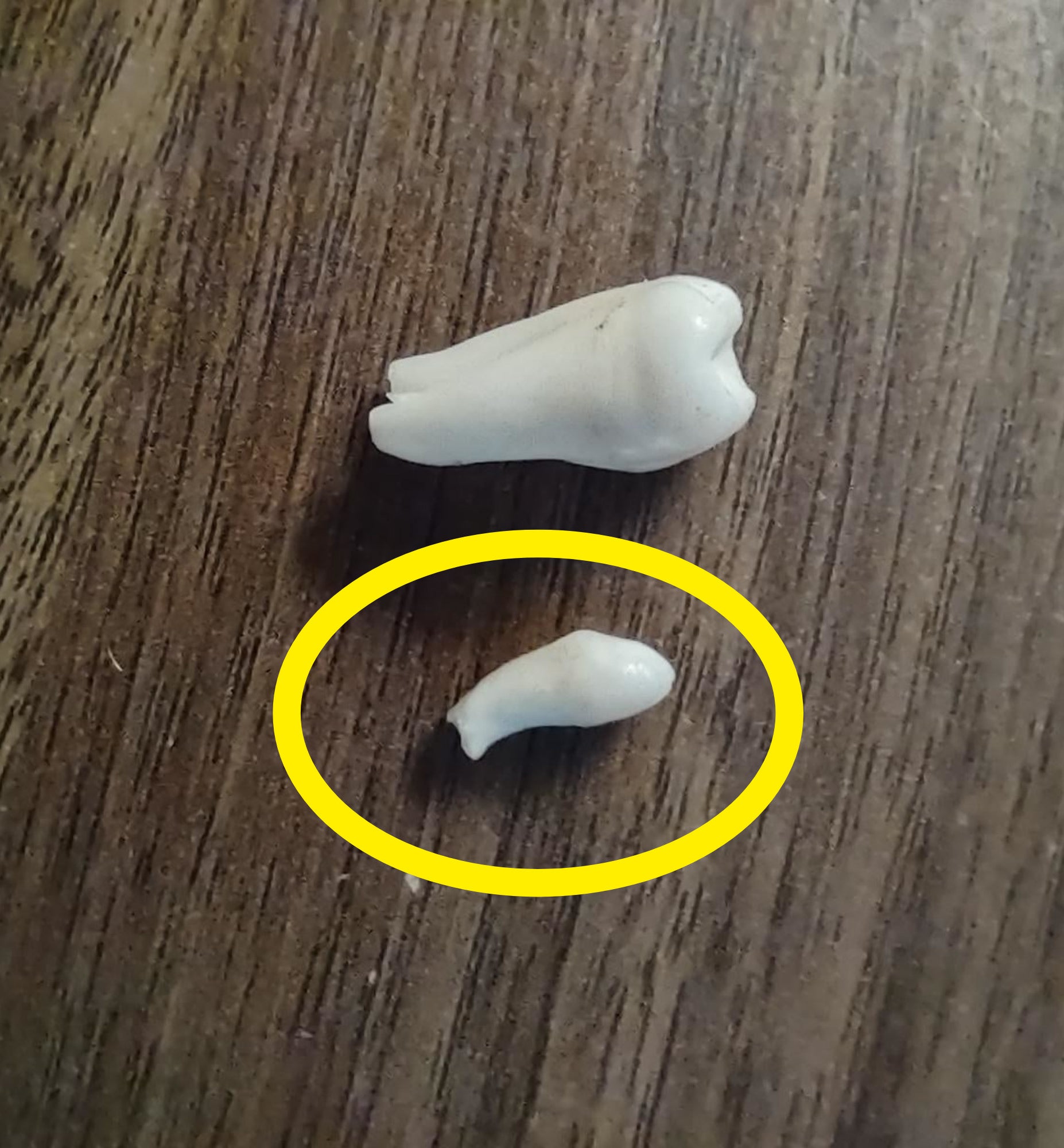 Two teeth side by side to show just how small one is