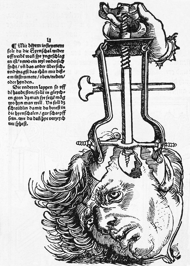 illustration of a head with a machine attached drilling into it