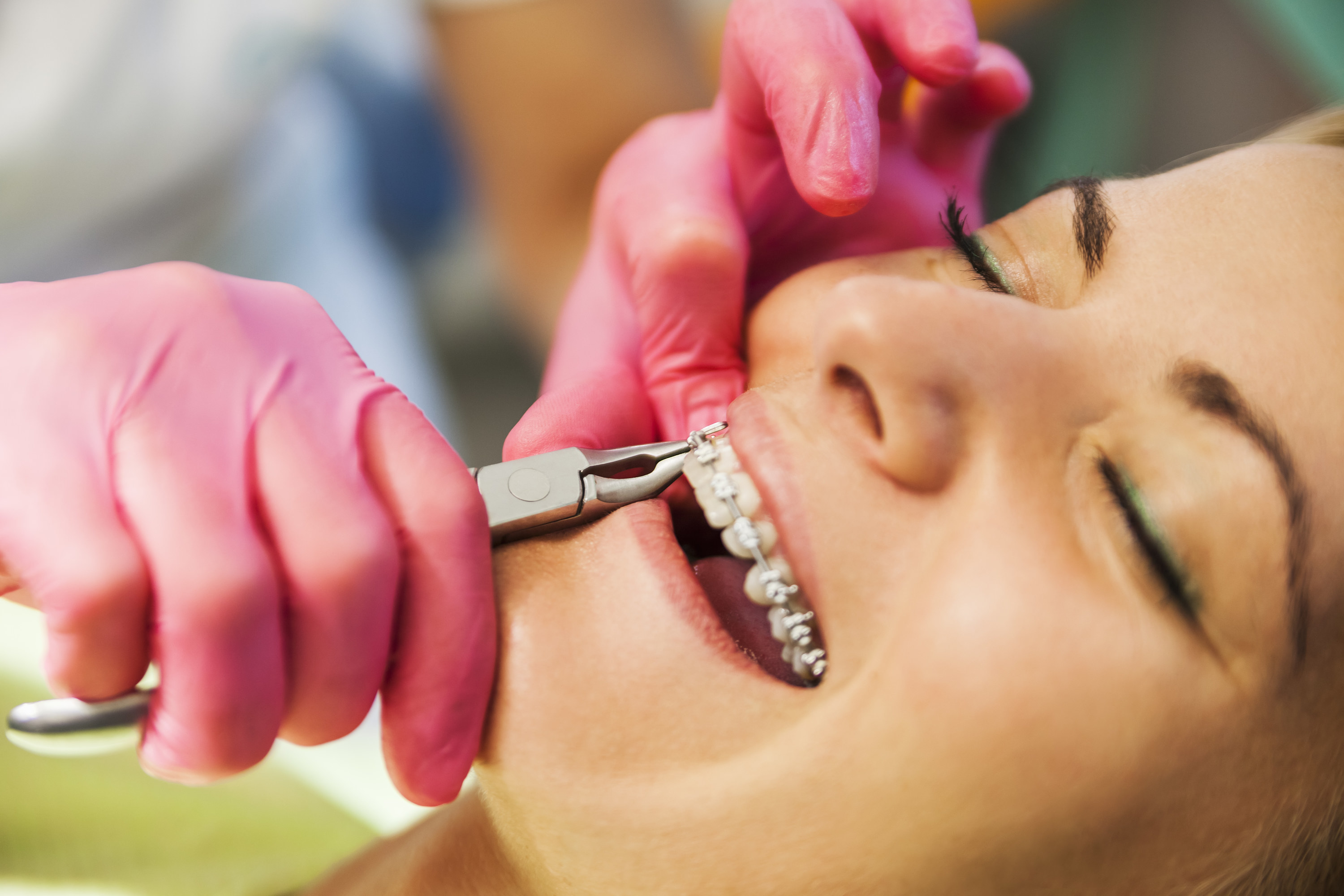 a girl getting her braces on at the orthodontist